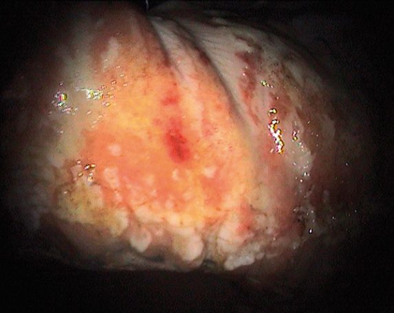 Maagzweren bij een paard